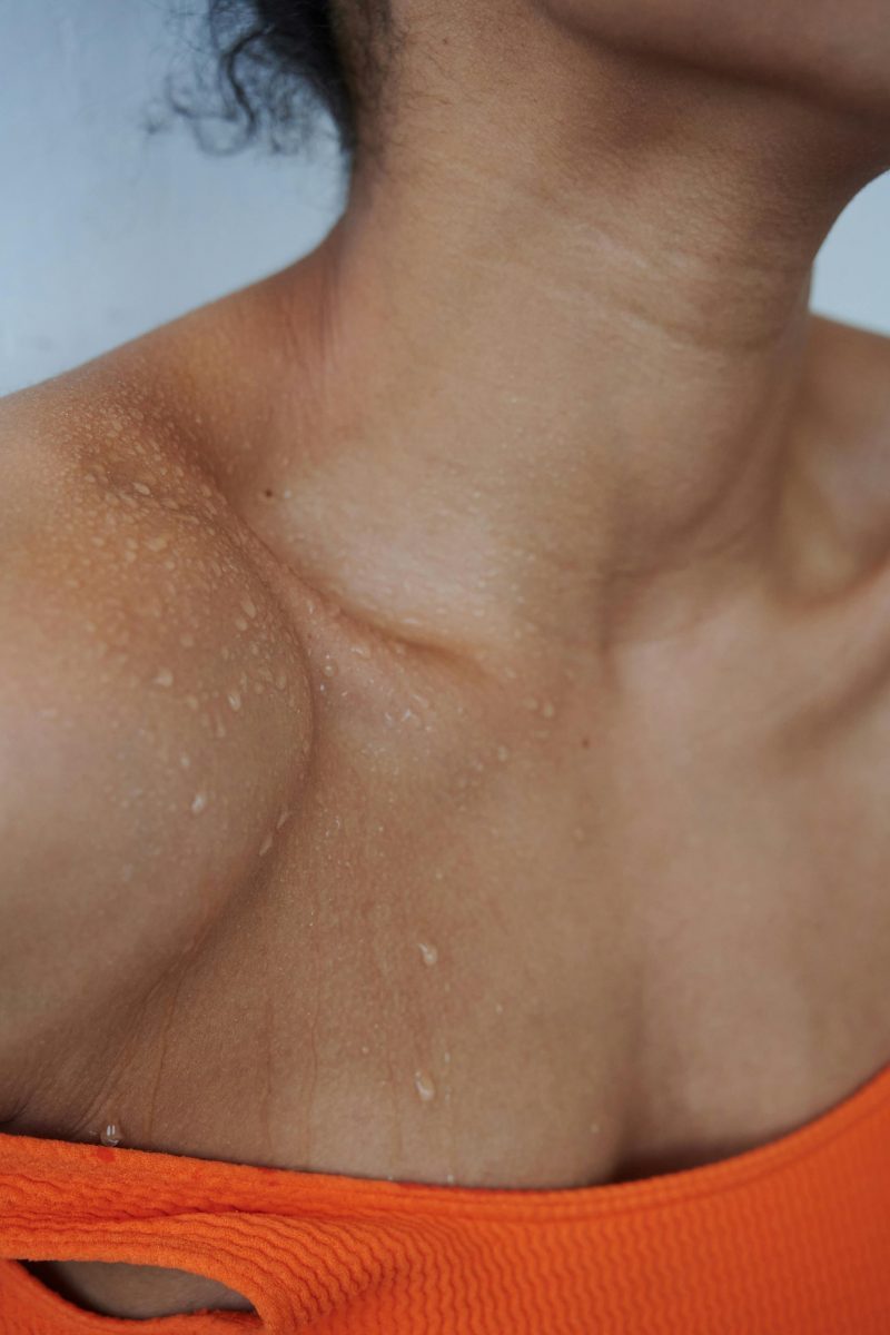 Kampf dem Schweiß: Wann Schwitzen nicht mehr normal ist